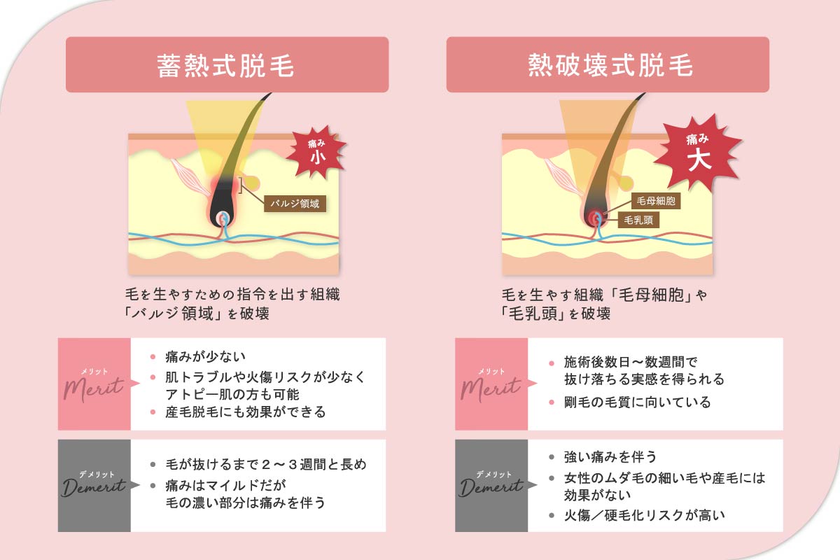 蓄熱式と熱破壊式のメリット・デメリット